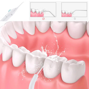 Nettoyant dentaire sans fil